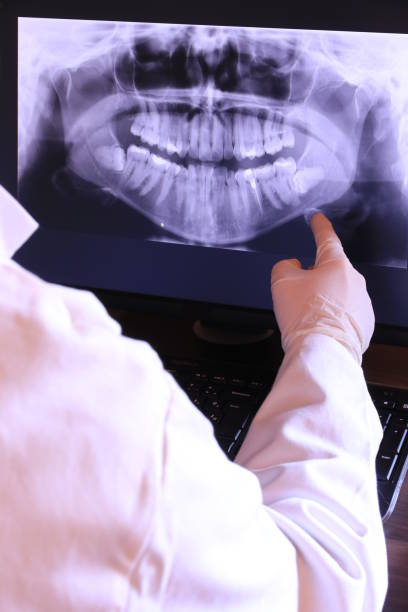 Best Emergency Dental Services for Seniors in Johnson City, NY